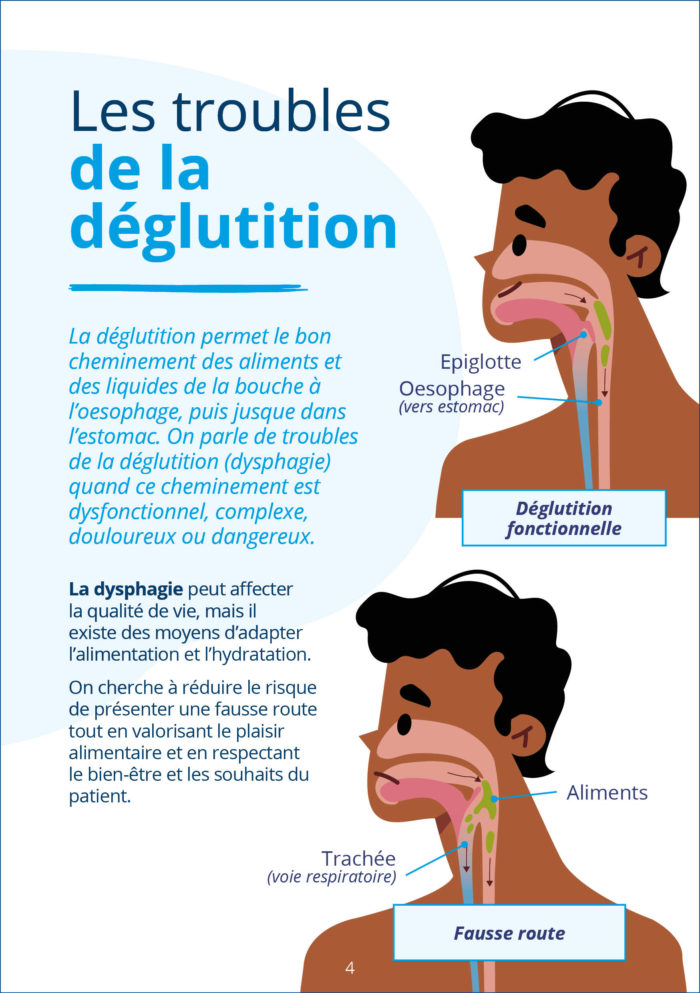 Troubles  de la déglutition -Schémas et définitions