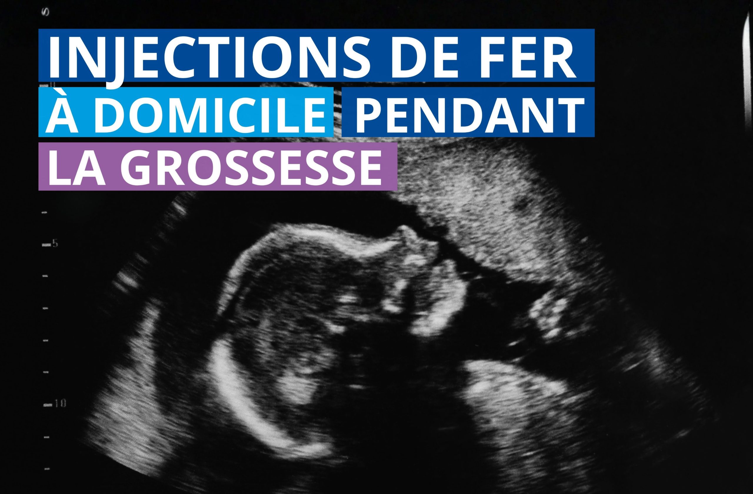 Injection de fer grossesse